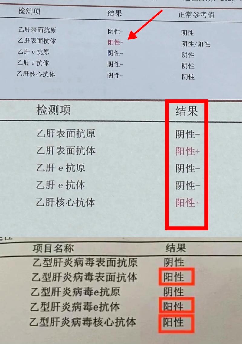 乙肝病毒检测结果解读：2.00E+06 IUML意味着什么？