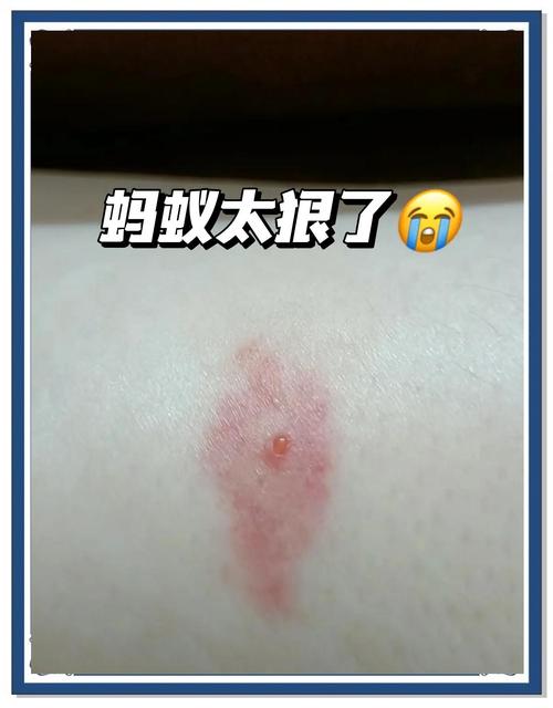 长期不用车蚂蚁泛滥怎么办？这些简单方法轻松解决！