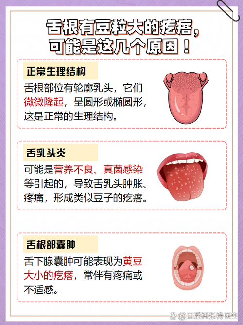 舌根对什么味道最敏感？日常测试方法简单学(自己动手轻松掌握)