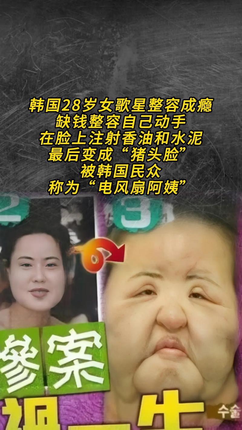 韩国歌手星真的整容了吗？出道前后变化对比分析！