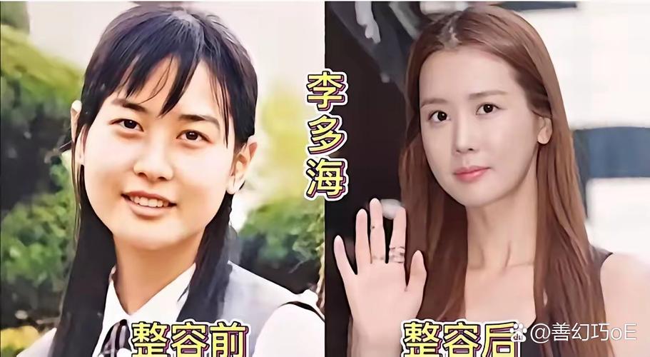 韩国歌手星真的整容了吗？出道前后变化对比分析！