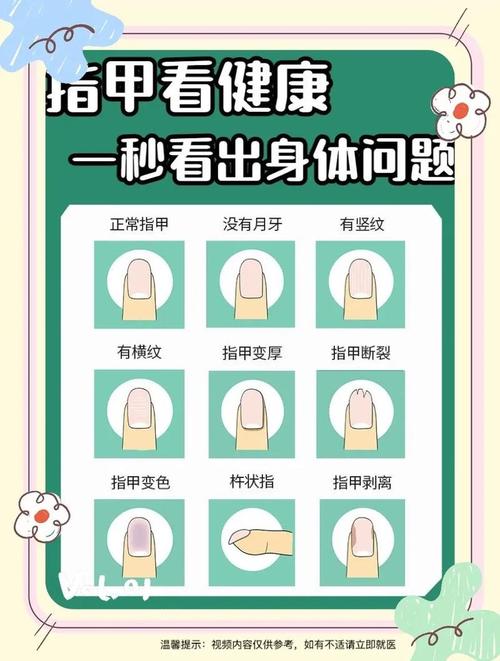 指甲月牙少表示什么健康问题？医生解答