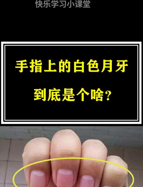 指甲月牙少表示什么健康问题？医生解答