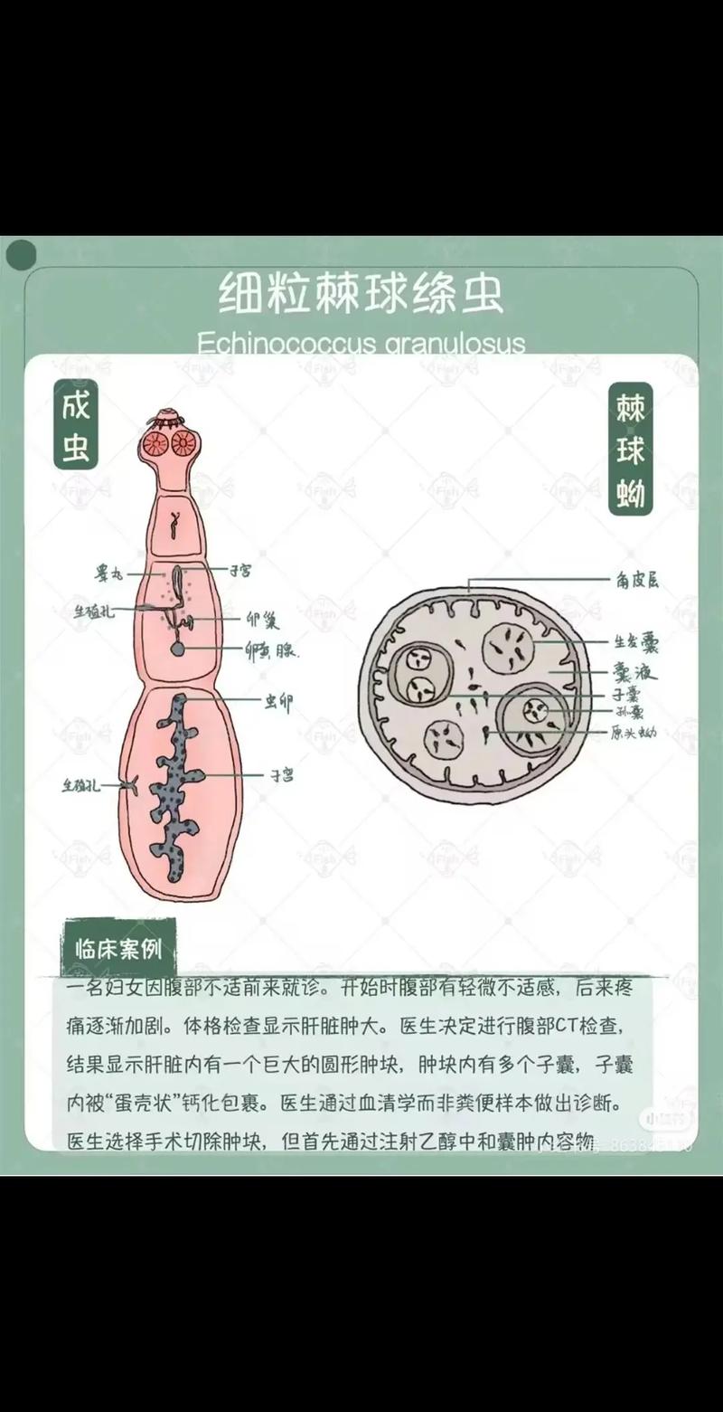 如何查找内部寄生虫的最新版本及安装指南