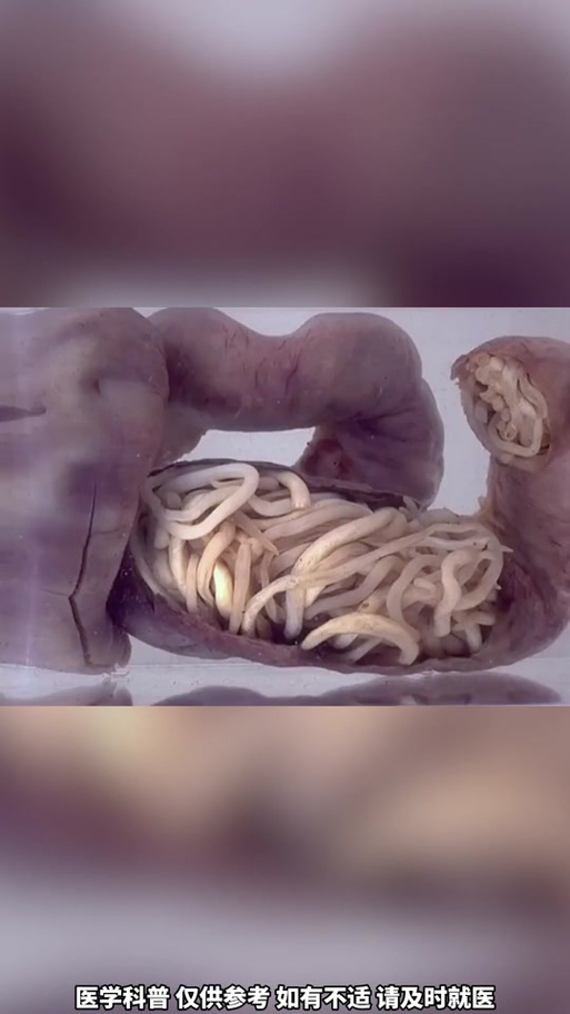 如何查找内部寄生虫的最新版本及安装指南